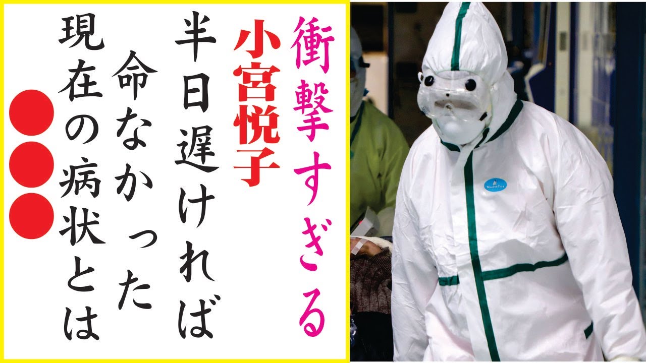 1765087941_maxresdefault-5613081-1030822-jpg